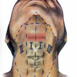 Medical Illustration